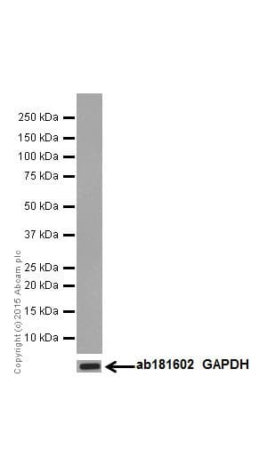 P53 Phospho S37 Antibody Epr17353 Ab182164  Western Blot Img520