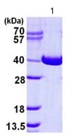 Recombinant Human NAGK protein(AB124563)
