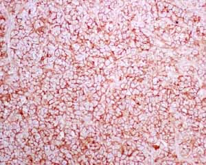 Anti-Syndecan-1 antibody [EPR6454](AB128936)