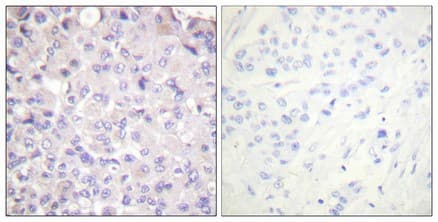 Anti-IKK beta (phospho Y188) antibody(AB194519)