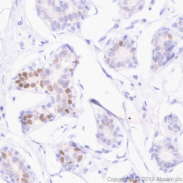 Anti-Estrogen Receptor alpha antibody [E115] - ChIP Grade(ab32063)