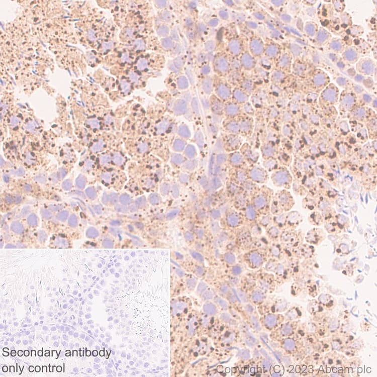 Fyco1 Antibody Epr28361 79 Bsa And Azide Free Ab316013  Immunohistochemistry Formalin Pfa Fixed Paraffin Embedded Sections Img426124