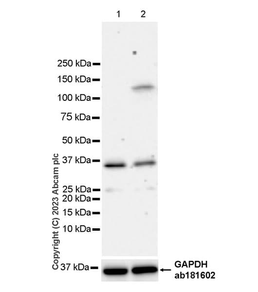 Anti-NFkB Inducing Kinase NIK antibody [EPR26101-23] - BSA and Azide free(AB314147)