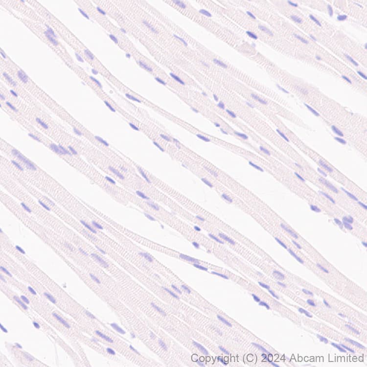 Atp6v0d2 Antibody Epr29173 521 Bsa And Azide Free Ab321810  Immunohistochemistry Formalin Pfa Fixed Paraffin Embedded Sections Img435570