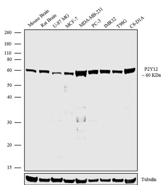 Anti-P2Y12 antibody [RP23040204](AB308032)