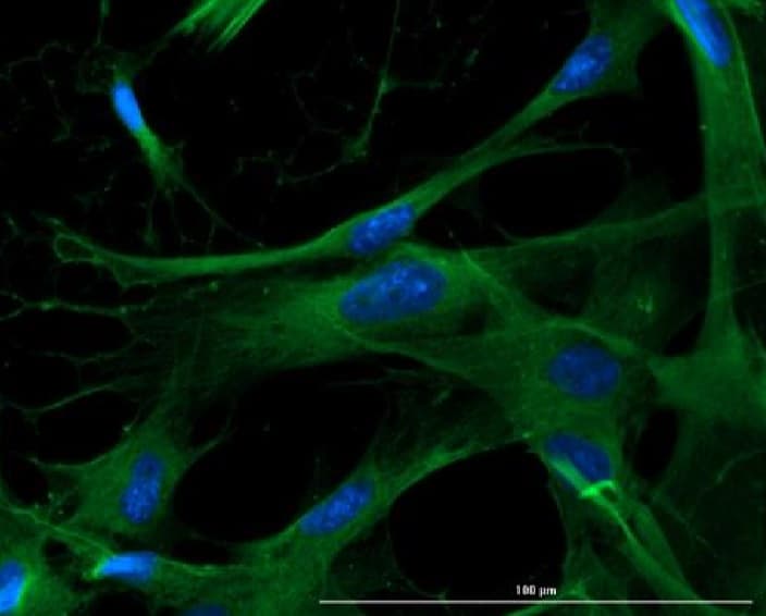 Anti-EAAT2 antibody(AB235202)