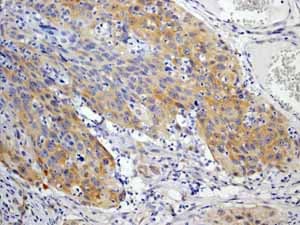 Anti-EIF2S1 (phospho S51) antibody [E90](AB32157)