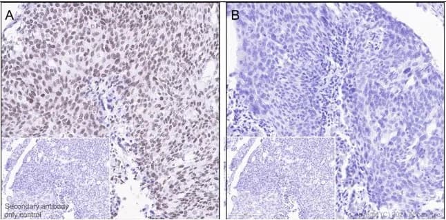 Anti-JAK2 (phospho Y1007 + Y1008) antibody [E132](AB32101)