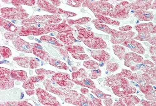 Anti-YTHDF1 antibody(AB230330)