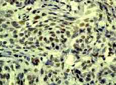 Anti-c-Myb (phospho S11) antibody [EP769Y](AB45150)