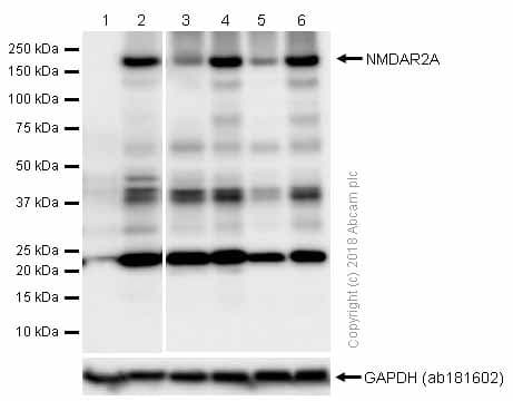 Anti-NMDAR2A antibody [EPR2465(2)](AB124913)