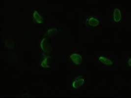 Anti-PDX1 antibody [OTI2A12](AB84987)
