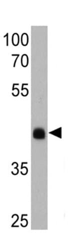 Anti-Rhodopsin antibody [1D4](AB5417)