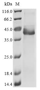 Ab289779  Sds Page Img172826