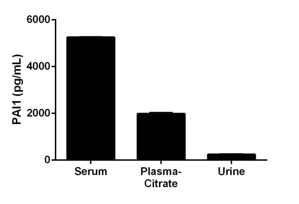 Rat PAI1 ELISA Kit (SERPINE1)(AB201283)