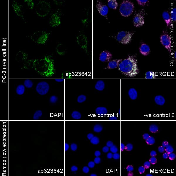 Anti-LAMP2 antibody [H4B4] - Lysosome Marker(AB25631)