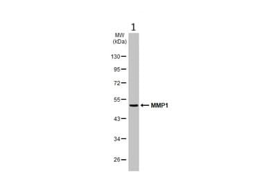 Anti-MMP1 antibody(AB137332)