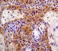 Anti-STAT6 antibody [YE361](AB32520)