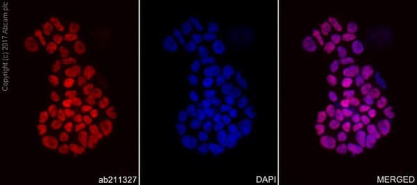 Anti-MASH1/Achaete-scute homolog 1 antibody [EPR19840](AB211327)