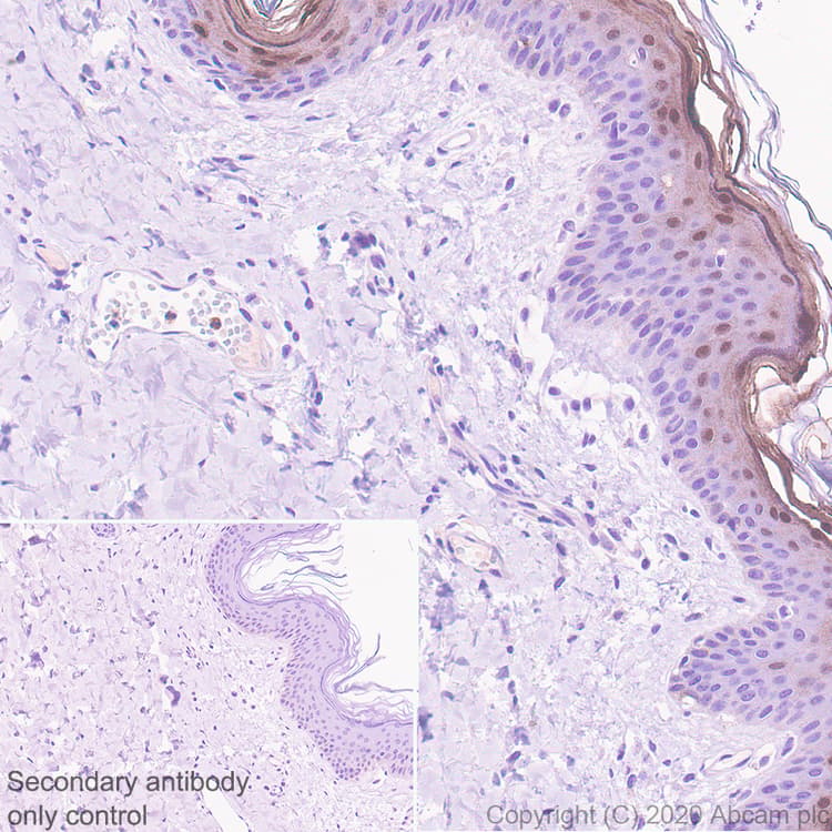 Psoriasin Antibody Epr23482 38 Ab275026  Immunohistochemistry Formalin Pfa Fixed Paraffin Embedded Sections Img41120