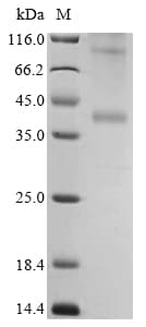 Ab289735  Sds Page Img168279