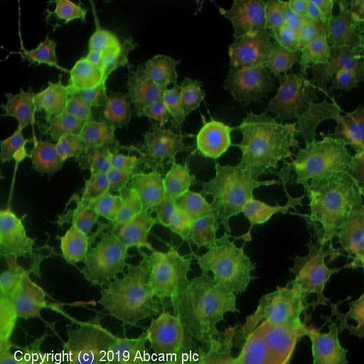 Anti-SNAP25 antibody(AB41455)