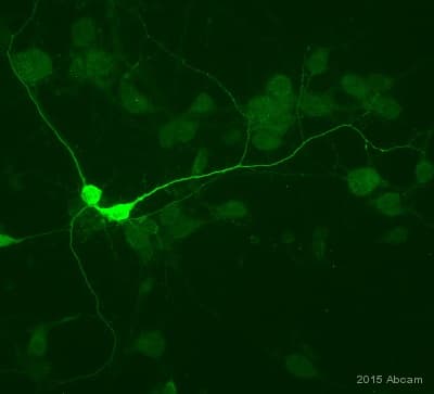 Anti-Parvalbumin antibody(AB11427)