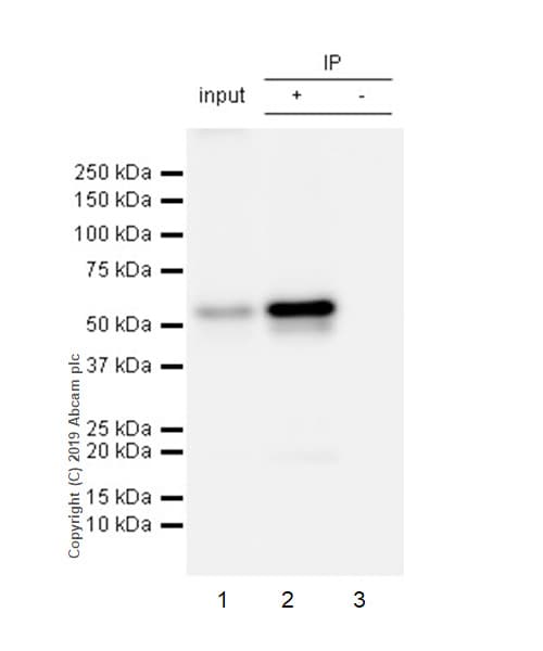 Anti-EFEMP1/Fibulin-3 antibody [EPR22855-4](AB256457)
