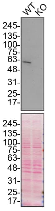 Anti-SQSTM1 / p62 (phospho S349) antibody [EPR20451] - BSA and Azide free(AB238445)