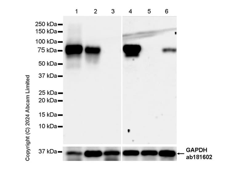 Alkaline Phosphatase Antibody Epr20428 147 Bsa And Azide Free Capture Ab252581  Western Blot Img440821