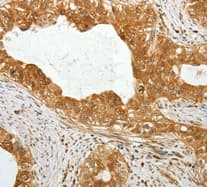 Tekt1 Antibody Ab182777  Immunohistochemistry Formalin Pfa Fixed Paraffin Embedded Sections Img69164