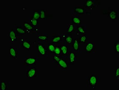 Anti-Annexin-11/ANXA11 antibody(AB236599)