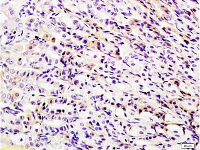 Rig I Ddx58 Antibody Ab216679  Immunohistochemistry Formalin Pfa Fixed Paraffin Embedded Sections Img84993