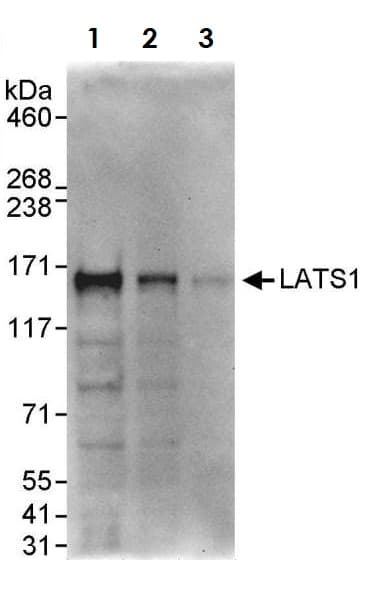 Lats1 Warts Antibody Ab70562  Western Blot Img164379
