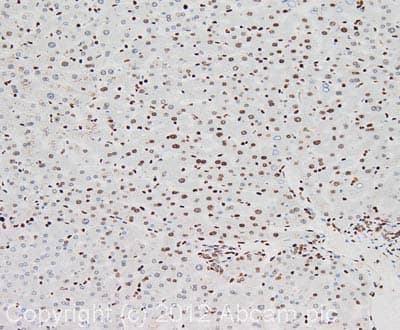 Nucleolin Antibody 364 5 Ab136649  Immunohistochemistry Formalin Pfa Fixed Paraffin Embedded Sections Img120629