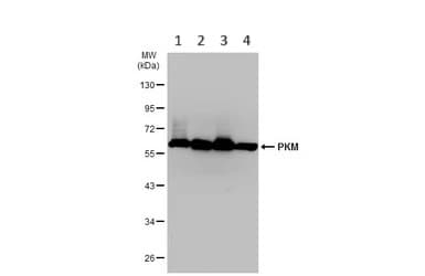 Pkm Antibody Ab137852  Western Blot Img449703