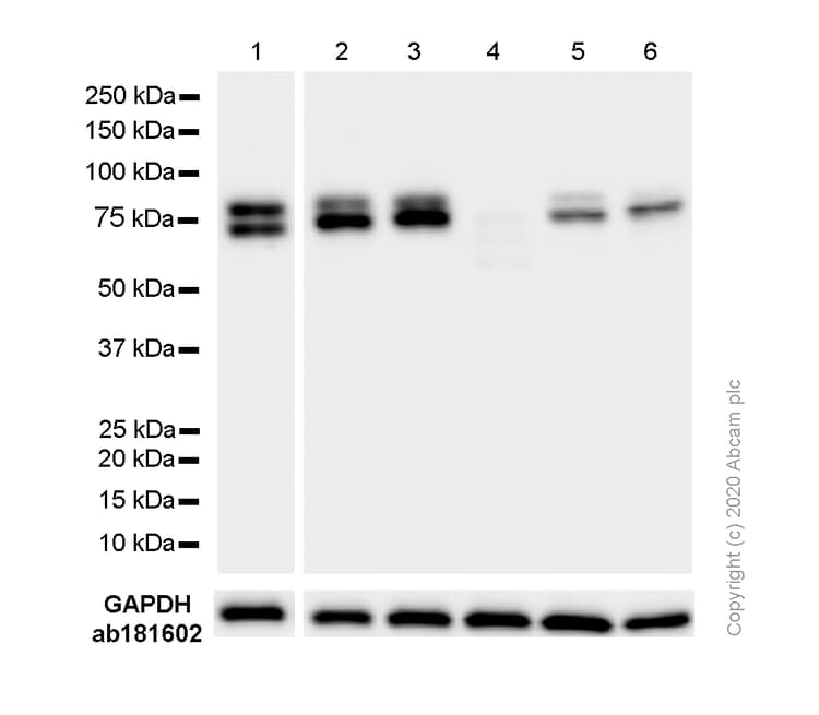 Ddx17 Antibody Epr13807b Ab180190  Western Blot Img54841