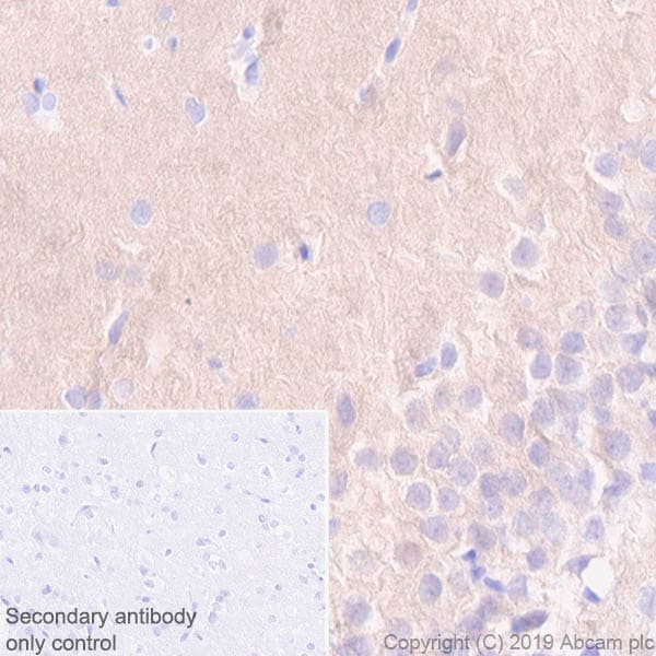Anti-Pan Trk antibody [EPR17341-4](ab246551)
