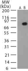Bacillus Anthracis Protective Antigen Antibody Ab13808  Western Blot Img90358
