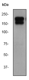 Anti-EGFR antibody [EPR39Y](AB76153)