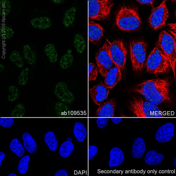 Anti-TDP43 antibody [EPR5810](AB109535)