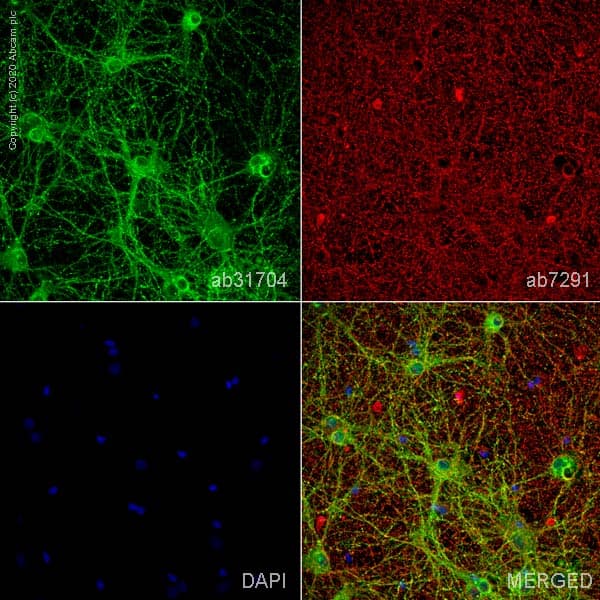 Anti-DCAMKL1 antibody(AB31704)