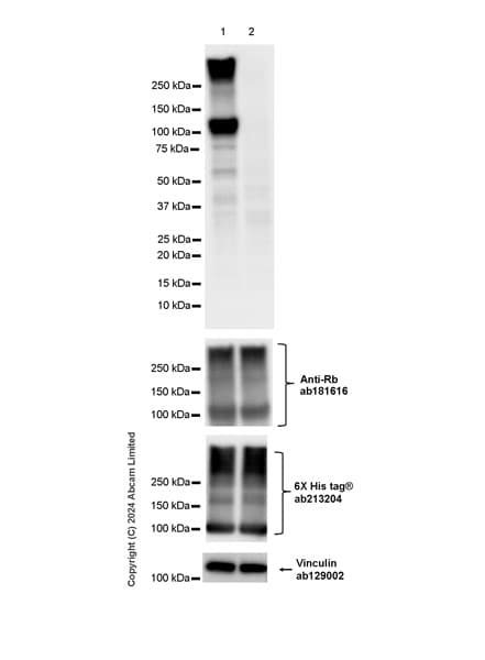 Anti-Rb antibody [EPR17512](AB181616)