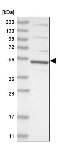 Anti-CDCA7L/HR1 antibody(ab246958)