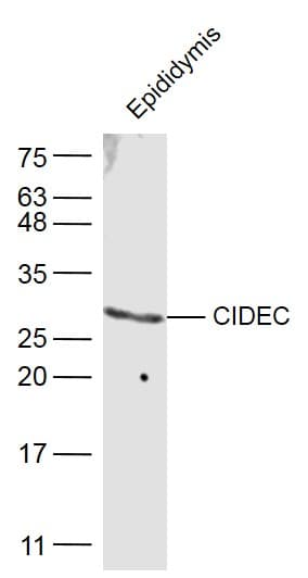 Anti-FSP27 antibody(AB213693)