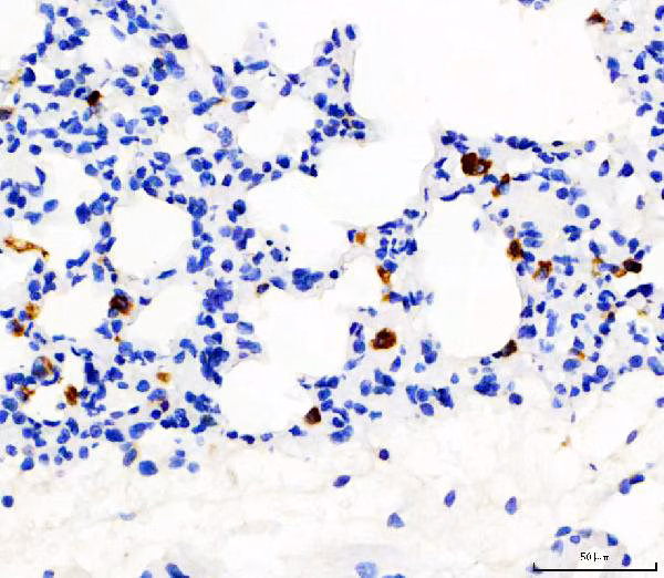 Cd68 Antibody Ab125212 Immunohistochemistry Formalin Pfa Fixed Paraffin Embedded Sections Img433740
