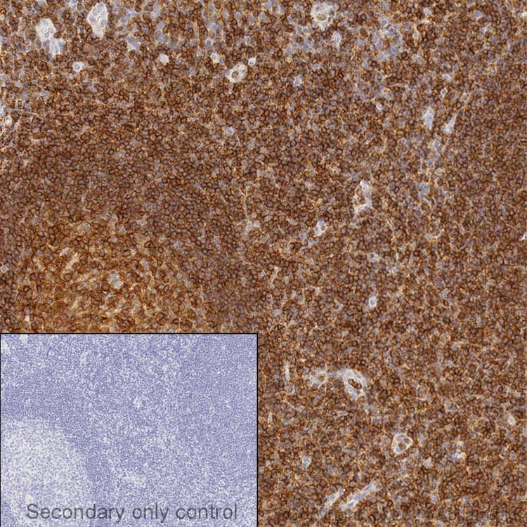 Anti-CD45 antibody(AB10558)