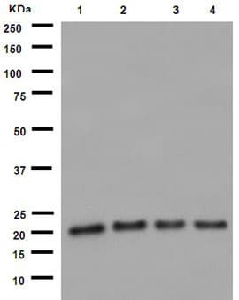 Anti-UFC1 antibody [EPR15014](AB189251)