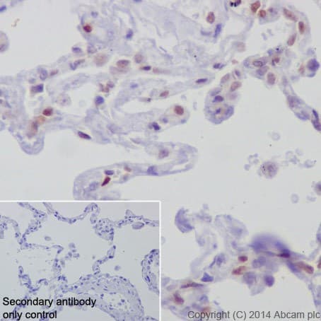 Anti-Rb antibody [EPR17512](AB181616)