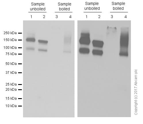 Anti-P Glycoprotein antibody [EPR10364-57](AB170904)